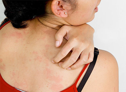 皮肤瘙痒起来神仙难办,敏感肌究竟该何去何从?